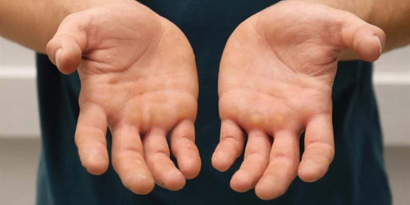 Mani rovinate dal freddo, 5 rimedi per averle sempre morbide e curate: funzionano al 100% 